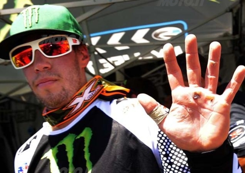 Steven Frossard: pi&ugrave; forte del dolore