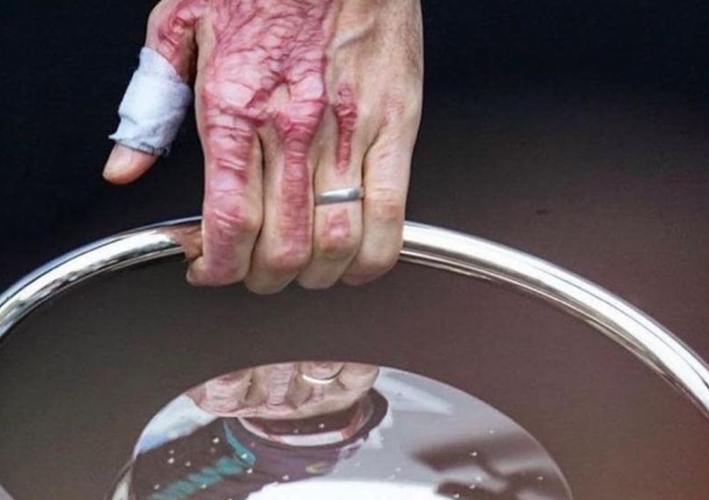 La mano dilaniata di Romain Grosjean che alza il trofeo a Indianapolis: la foto simbolo della rinascita 