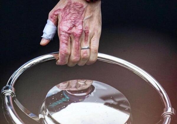 La mano dilaniata di Romain Grosjean che alza il trofeo a Indianapolis: la foto simbolo della rinascita 