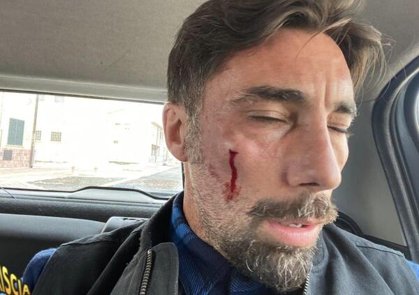 Vittorio Brumotti aggredito a San Severo, ecco l&#039;attimo esatto in cui riceve il pugno [VIDEO]