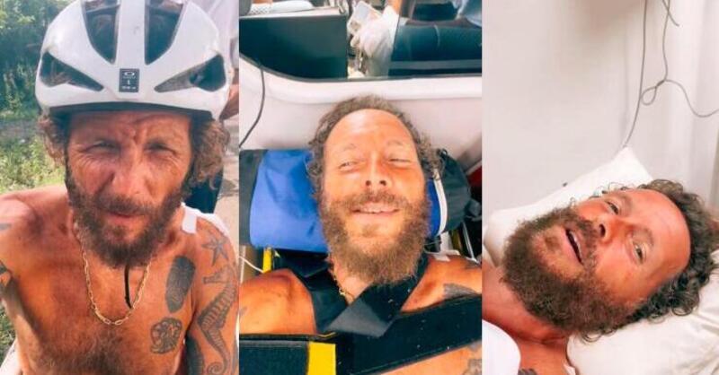 Jovanotti, dopo l&#039;incidente in bici i medici hanno sbagliato l&#039;operazione: &quot;Ho una gamba pi&ugrave; corta&quot;. Ecco cos&#039;&egrave; andato storto