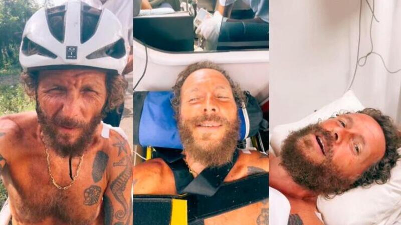 Jovanotti, dopo l&#039;incidente in bici i medici hanno sbagliato l&#039;operazione: &quot;Ho una gamba pi&ugrave; corta&quot;. Ecco cos&#039;&egrave; andato storto