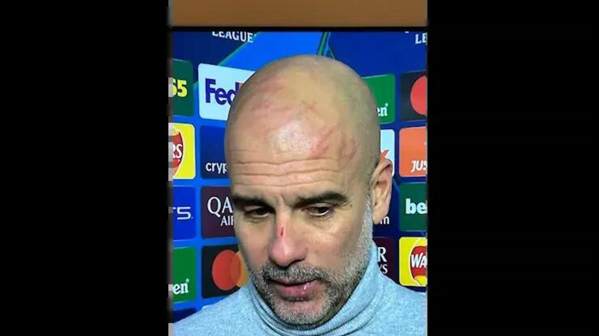 Il volto ferito di Guardiola