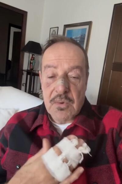 L'attore Massimo Lopez investito da un pirata della strada