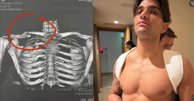 MotoGP 2025. GP del Giappone. Le prime parole di Jorge Martin dopo l&rsquo;incidente: &ldquo;Fa male, ma non mollo&rdquo;