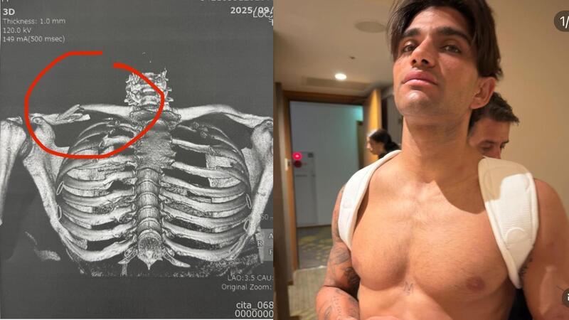 MotoGP 2025. GP del Giappone. Le prime parole di Jorge Martin dopo l&rsquo;incidente: &ldquo;Fa male, ma non mollo&rdquo;