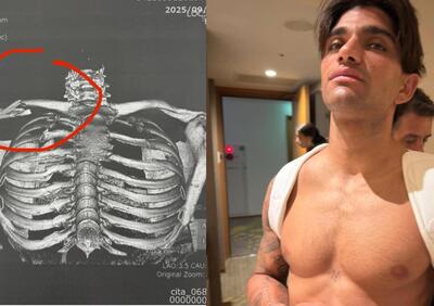 MotoGP 2025. GP del Giappone. Le prime parole di Jorge Martin dopo l’incidente: “Fa male, ma non mollo”