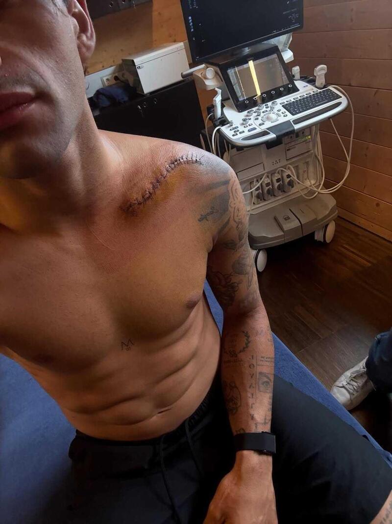 MotoGP 2025, Jorge Martin sulle orme di Marc Marquez: riabilitazione al Red Bull Athlete Performance Center [GALLERY]