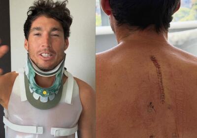 MotoGP 2026. Le prime parole di Aleix Espargaro dopo l'incidente: Finalmente sono in piedi [VIDEO]